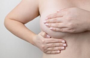 La ptose mammaire est-elle inévitable ?